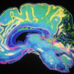 Our discovery may lead to a breakthrough in treatment for those who suffer from obsessive-compulsive disorder (OCD).