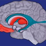 Cerebrum Substance Irregularity Recognized in OCD