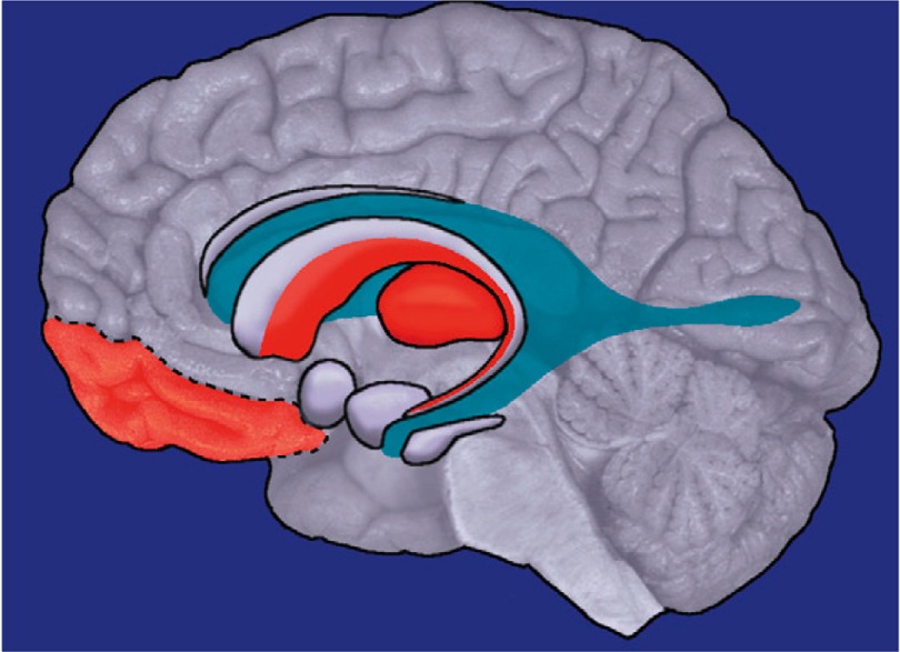 Cerebrum Substance Irregularity Recognized in OCD